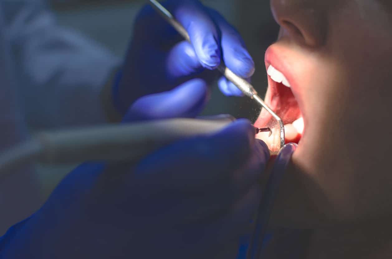Can I Sue for Medical Malpractice in West Palm Beach if I Suffer Nerve Damage After Dental Work?