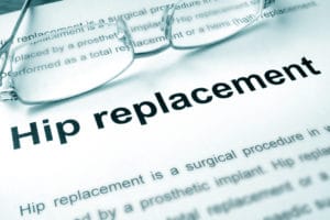 Hip Replacement Surgery