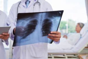 How Hollander Law Firm Accident Injury Lawyers Can Help After a Radiological Error in West Palm Beach